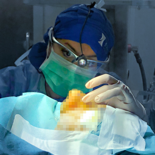 Rinoplastia Ultras�nica